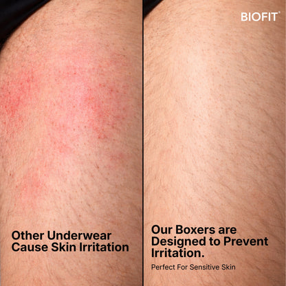 BIOFIT Essentials Boxers 5-Pack Red | + 5 FREE